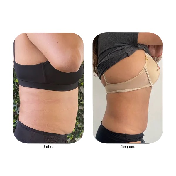 Antes y después espalda y flanco lateral — Método Hebe